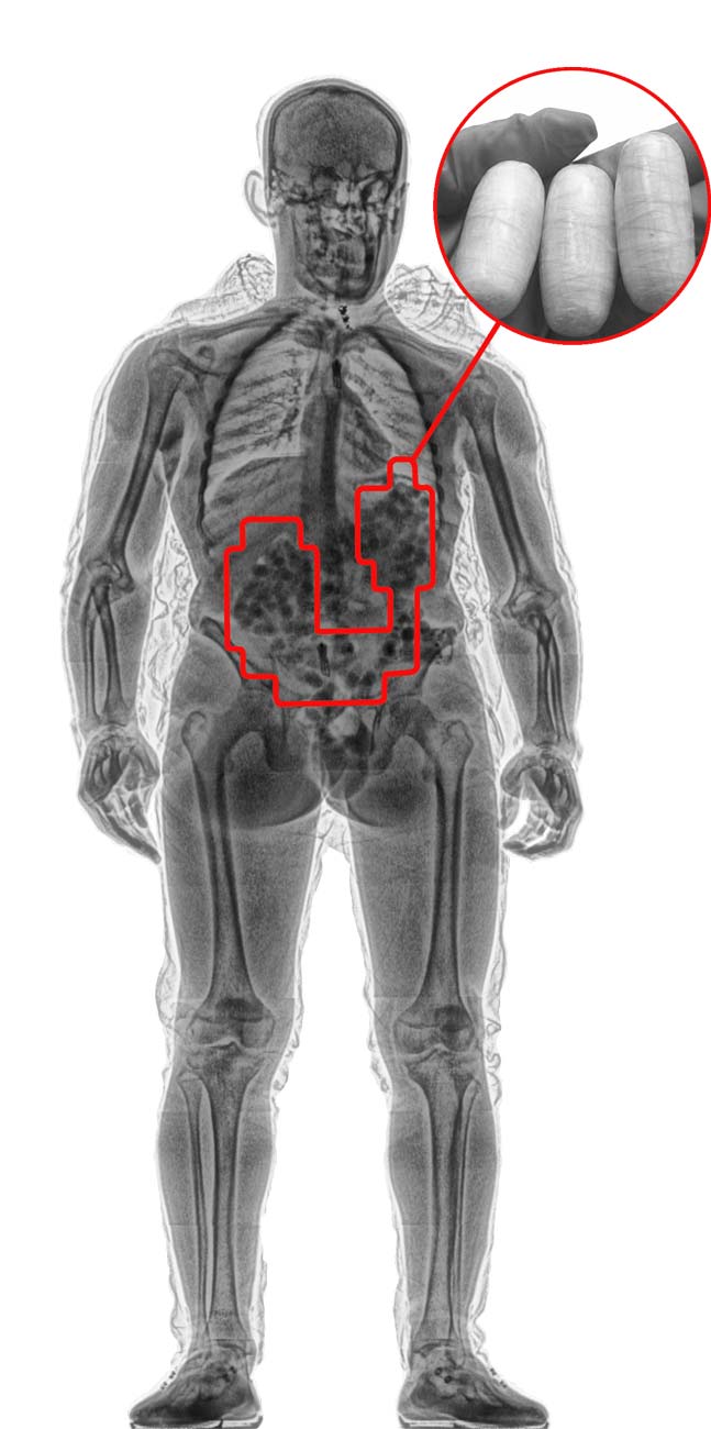 Contraband X-ray body scanner